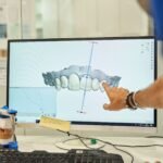 3D digital orthodontic treatment planning displayed on a computer screen during a dental consultation for clear aligner smile design