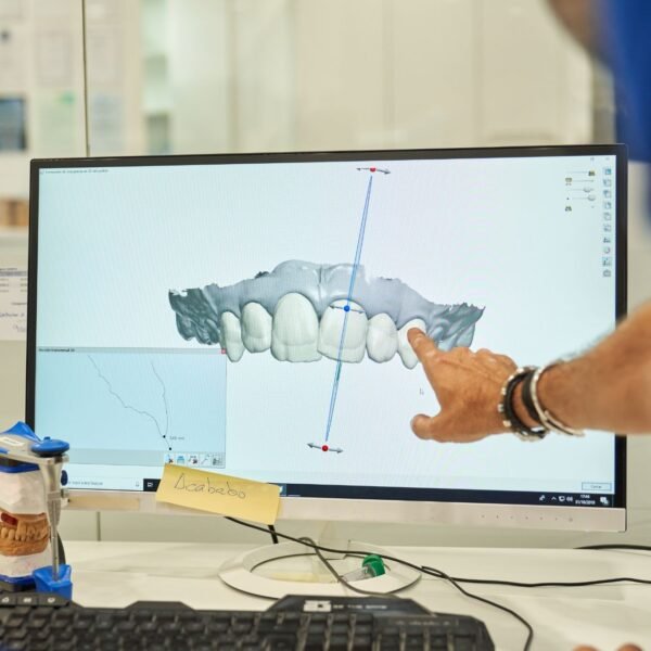 3D digital orthodontic treatment planning displayed on a computer screen during a dental consultation for clear aligner smile design